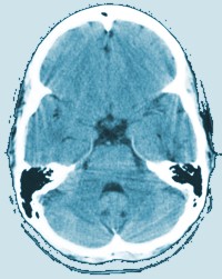 Brain Scan